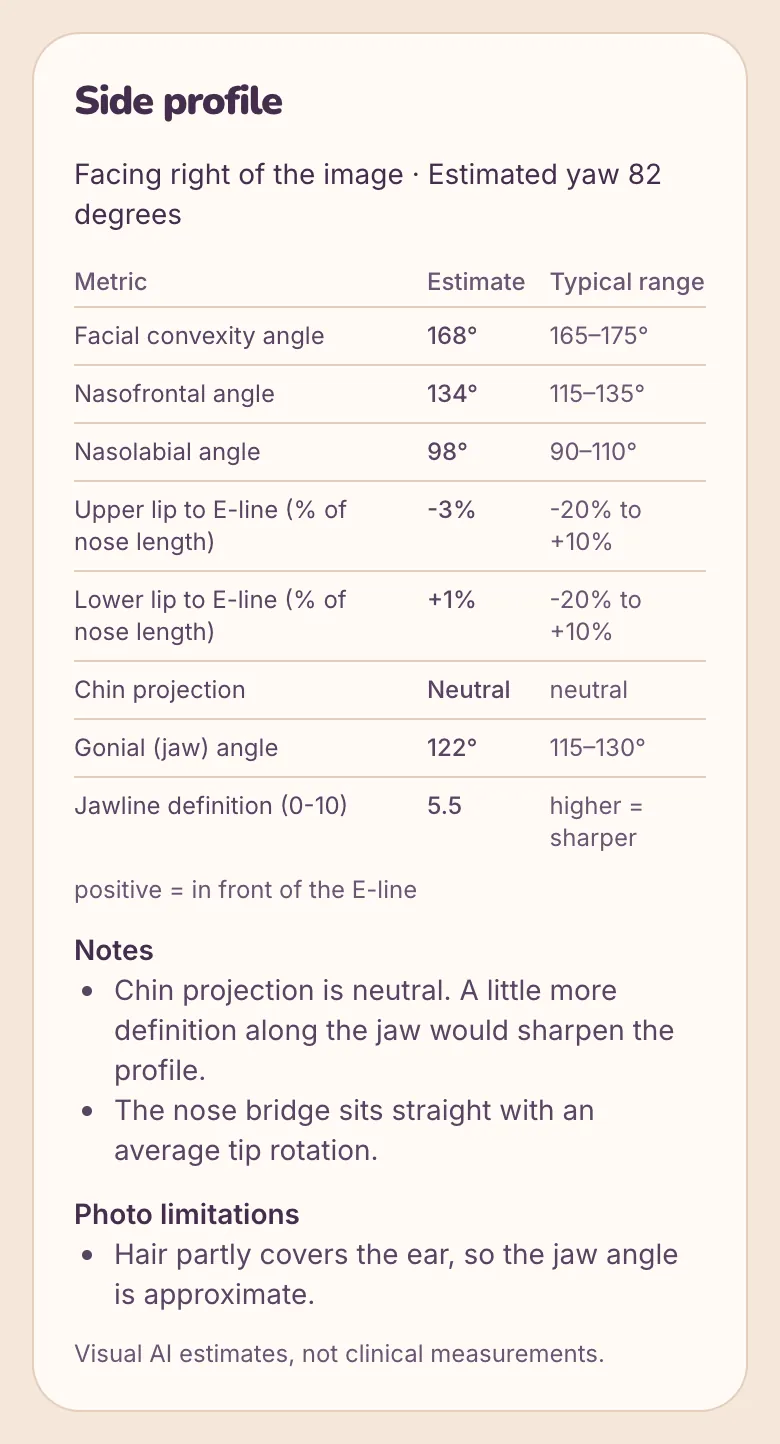 Sample full report — side profile measurements, fictional AI-generated person