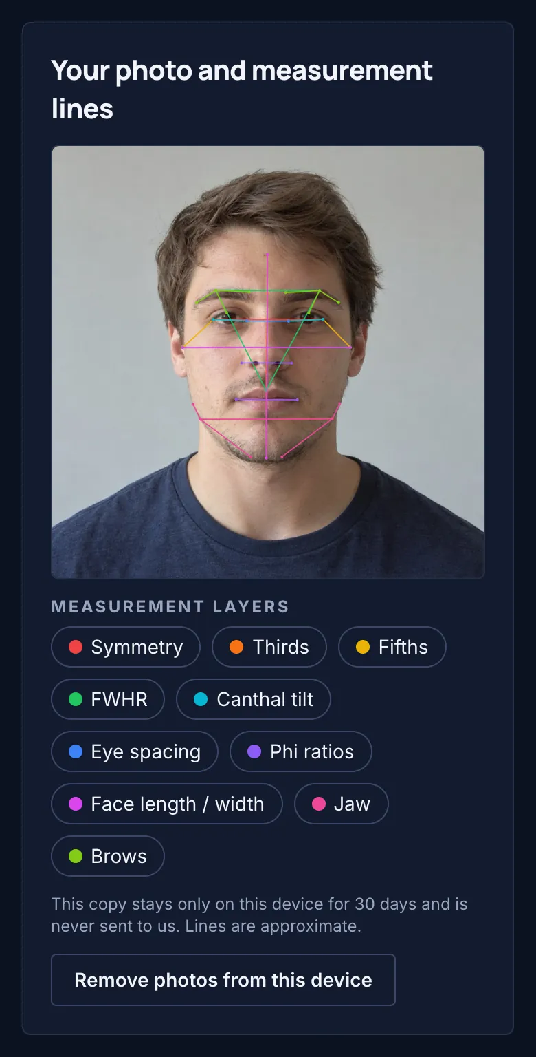 Sample full report — measurement lines drawn on the photo, fictional AI-generated person
