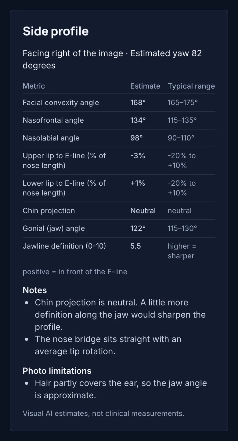Sample full report — side profile measurements, fictional AI-generated person